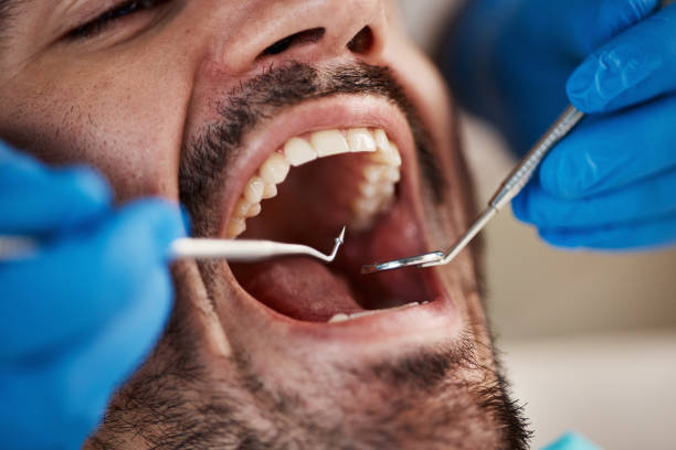 Tooth Infection Emergency Dentist in MI